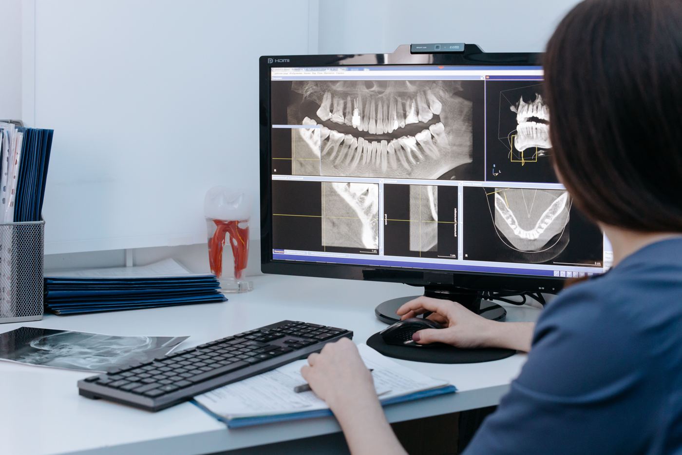 Externalizar radiología