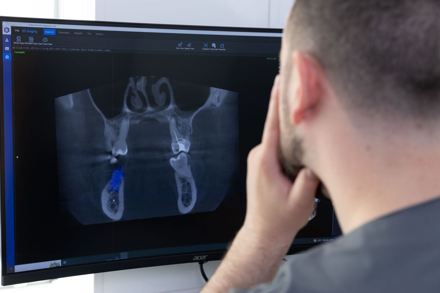 Informes 3D Cone Beam