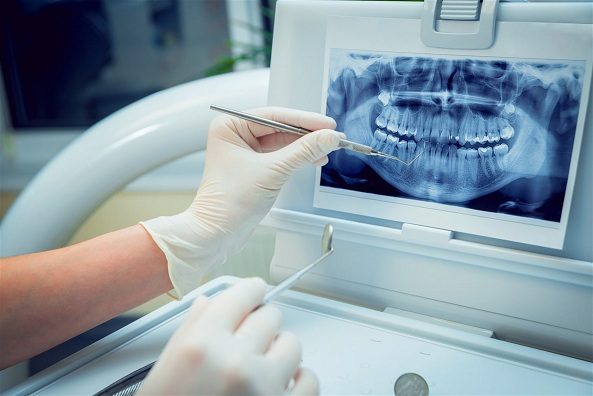Radiografía panorámica dental en revisión